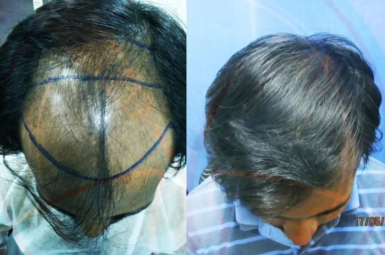 Before After